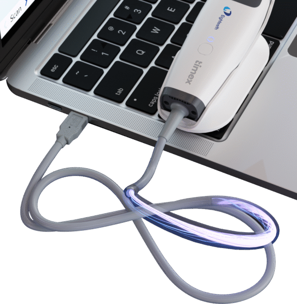 Scanner Intraoral Timex Helios 500 Gnatus Digital - Imagem 6